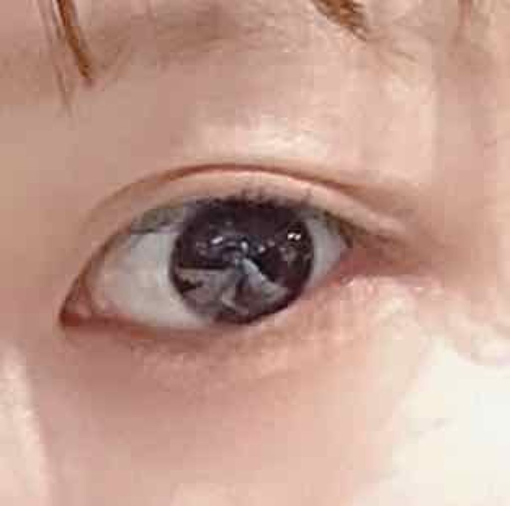 のびーるアイテープ(絆創膏タイプ、レギュラー)/DAISO/二重まぶた用アイテムを使ったクチコミ(1枚目)