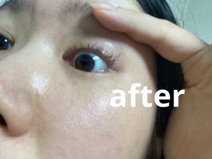 MATSUGE OMOI プレミアムアイラッシュセラム/MATSUGE OMOI/まつげ美容液を使ったクチコミ(3枚目)