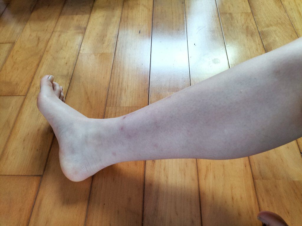 今日からひなちゃんねる様の脚やせトレーニングを1週間続けていきます。

お見苦しいかもですが、脚の写真も毎日投稿します‼️

 頑張ります🔥




動画こちらです⬇⬇
https://youtu.be/O5cwCtoWndE



#ダ