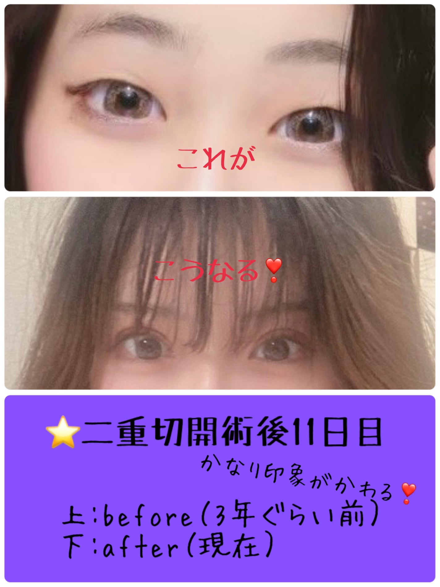 ãããœãð¡ãã©ãã100 on LIPS ãä»åã¯æãšä»æ¥ã®ãŸã¶ãã®æ¯èŒã§ãâïžæšæ¥ãŸã§ã¡ã¬ããããŠãŸãã..ãïŒ1æç®ïŒ