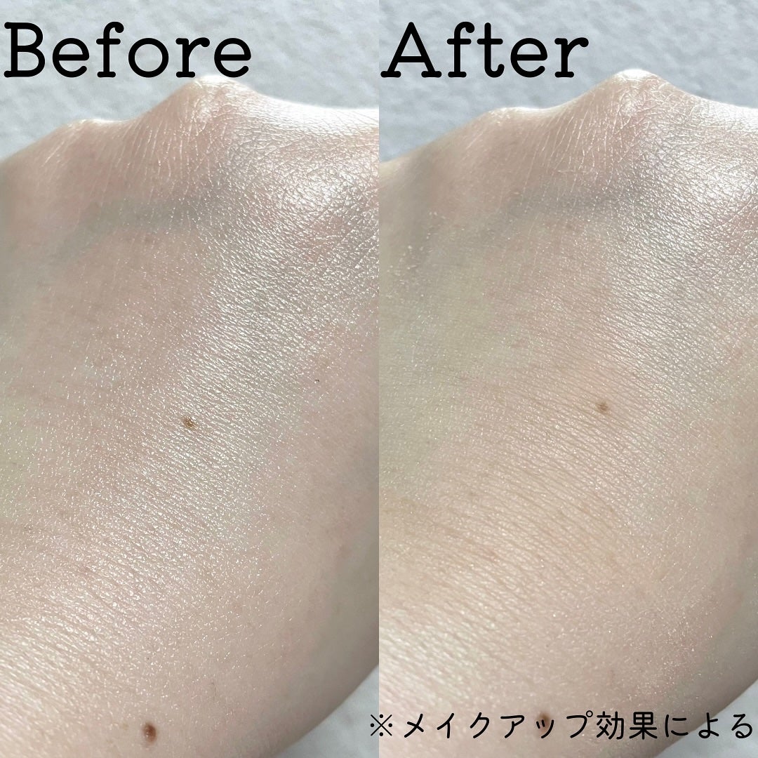 ã¢ãããµ ããŒãã§ã¯ã UV ãã©ãã·ã¥ãªã³ããŠããŒ/ã¢ãããµ/æ¥çŒãæ¢ãããŠããŒã䜿ã£ãã¯ãã³ãïŒ5æç®ïŒ