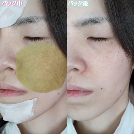 1番 シカ丸ごと水分整肌パッド/numbuzin/トナーパッドを使ったクチコミ(7枚目)