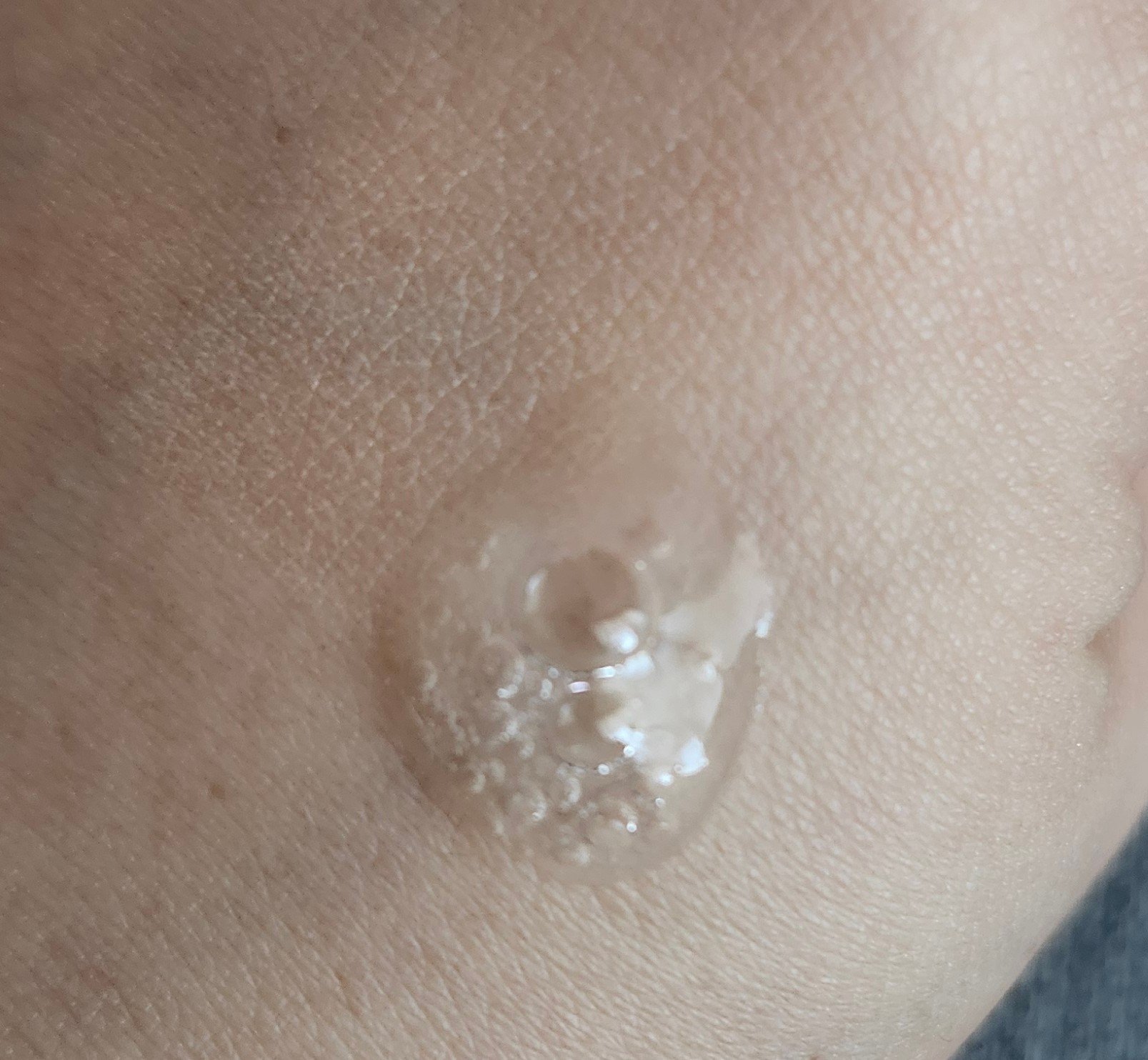 乾燥さん 薬用水分力ブライトニングエッセンス【医薬部外品】/乾燥さん/美容液を使ったクチコミ（2枚目）