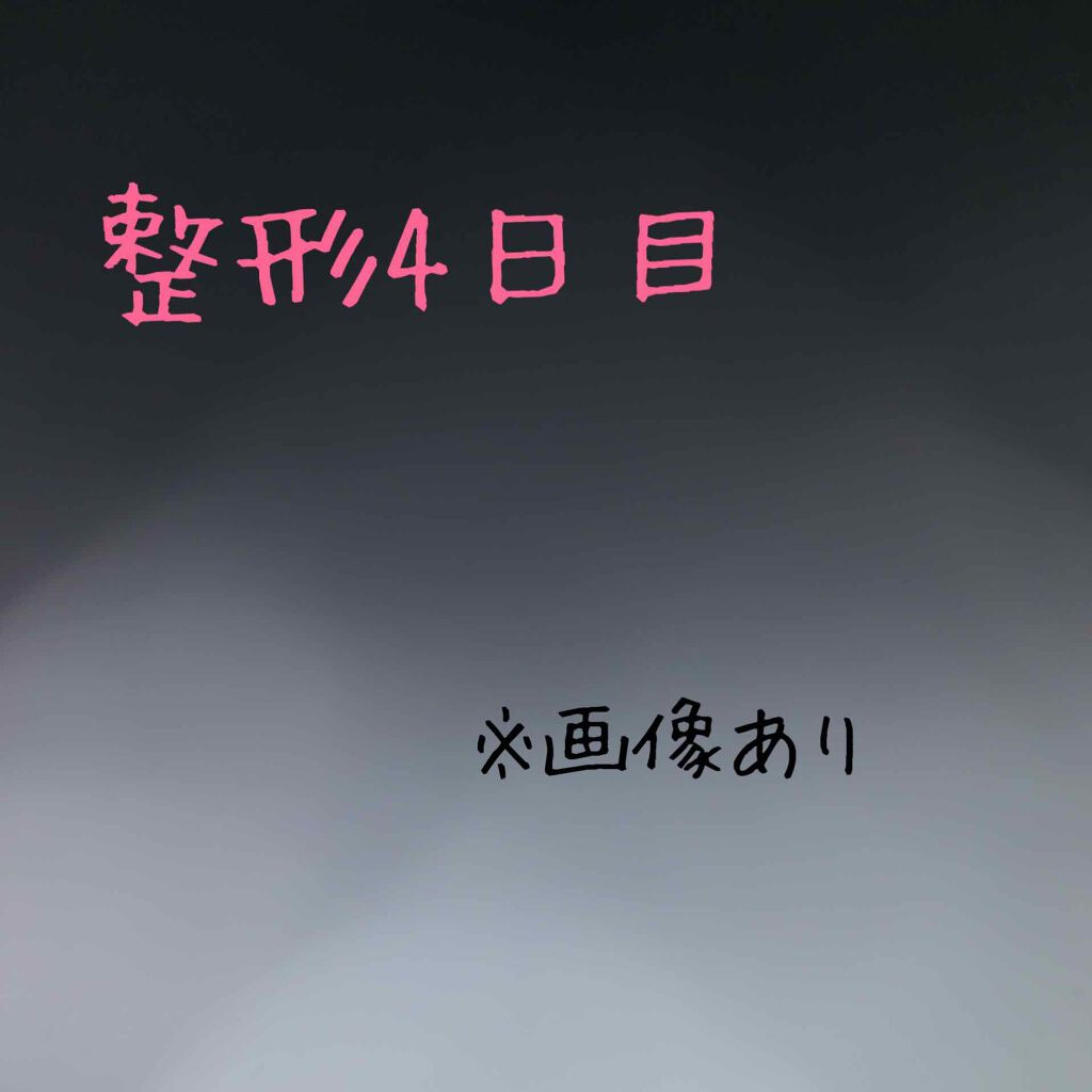 二重整形/その他を使ったクチコミ（1枚目）
