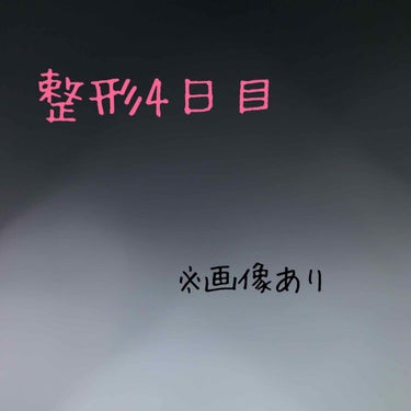 SBCフォーエバー二重から四日目
昨日は特に変わりありませんでした。
今日は目頭の所が黄色くなりました。
化粧はもうして大丈夫なので、化粧でなんとかなるかな〜と思います。

二重幅はまだ太いですね。
涙