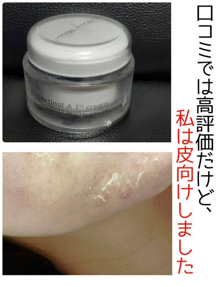 レチノールA 1% アドバンスドリバイタリゼーションクリーム/Life-flo/フェイスクリームを使ったクチコミ(1枚目)