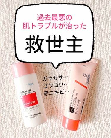 ＼効果てきめん／
ここ最近、肌の状態が
過去最悪だったんです😢

まず肌がカサカサ。そしてかゆい。
全体的に粉がふいてゴワゴワ。
ついには赤ニキビまででき始める…
敏感肌用の化粧水でも痛いし
メイクもで