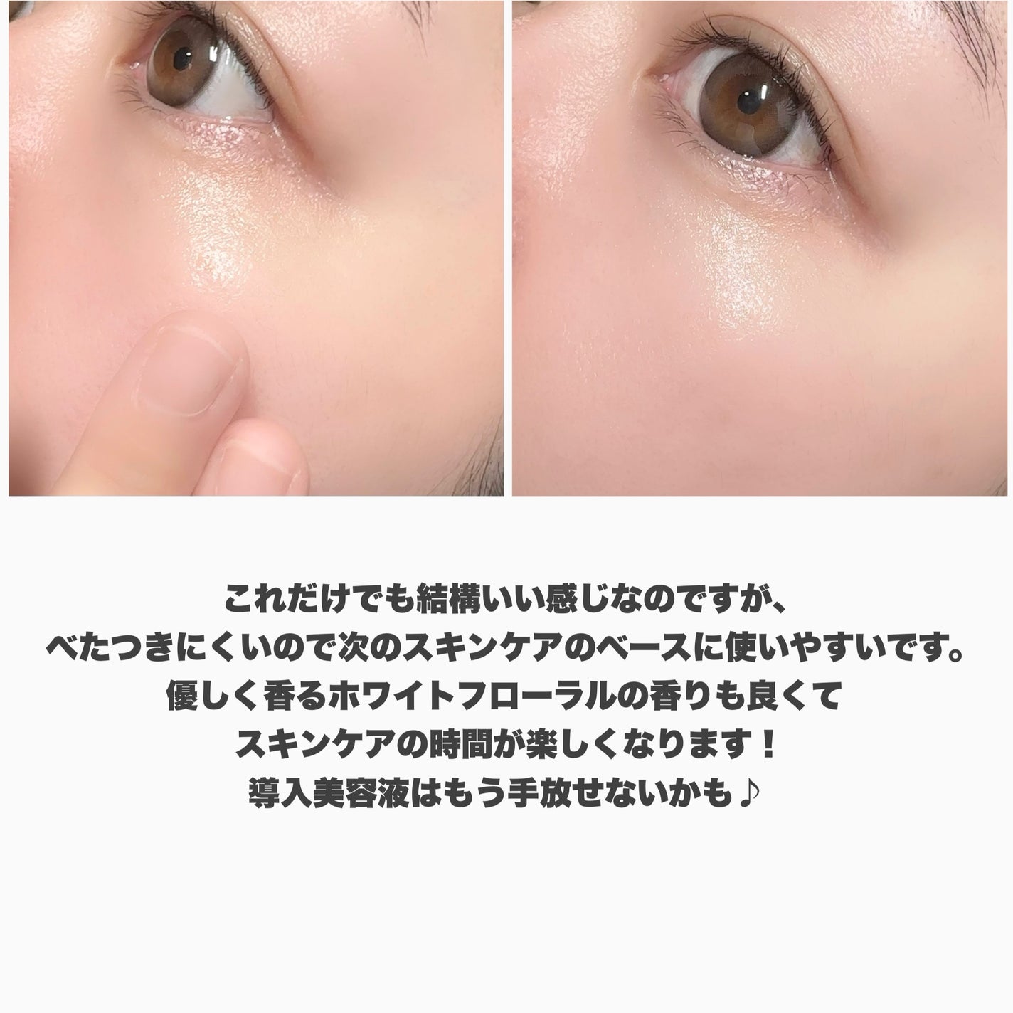 ファーストセラム/Rosemiu/美容液を使ったクチコミ(6枚目)