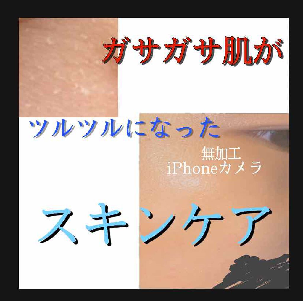 オードムーゲ 薬用ローション（ふきとり化粧水）/オードムーゲ/拭き取り化粧水を使ったクチコミ（1枚目）