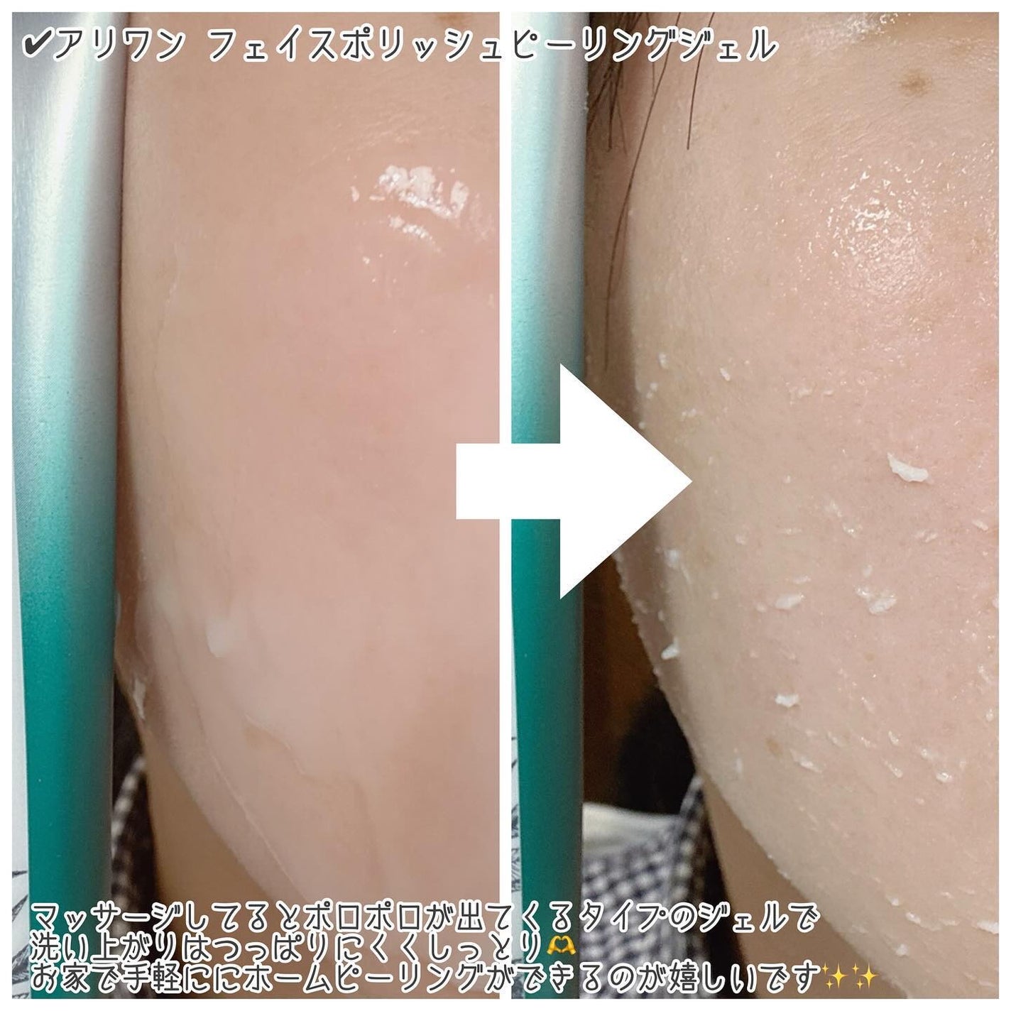 フェイスポリッシュピーリングジェル ティーツリー/ALLIONE/その他洗顔料を使ったクチコミ(3枚目)