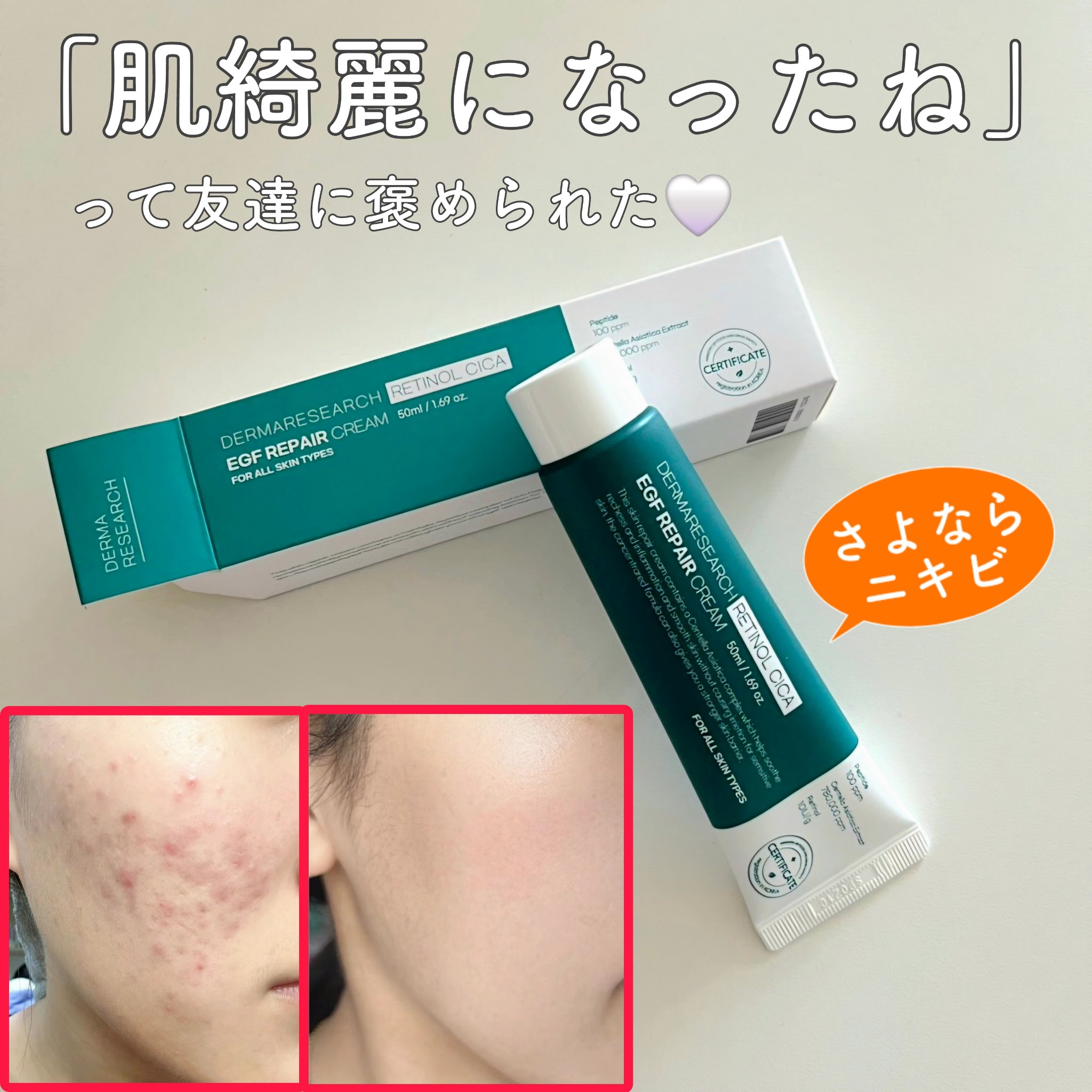 レチノールシカEGFリペアクリーム/DERMA RESEARCH/フェイスクリームを使ったクチコミ（1枚目）