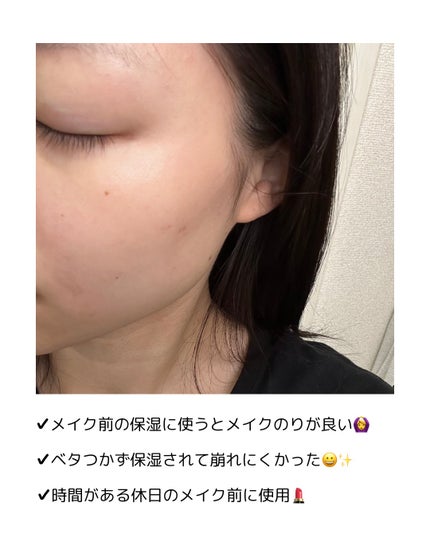 ウォンジョンヨ モイストアップレディスキンパック DM N/Wonjungyo/シートマスク・パックを使ったクチコミ(4枚目)