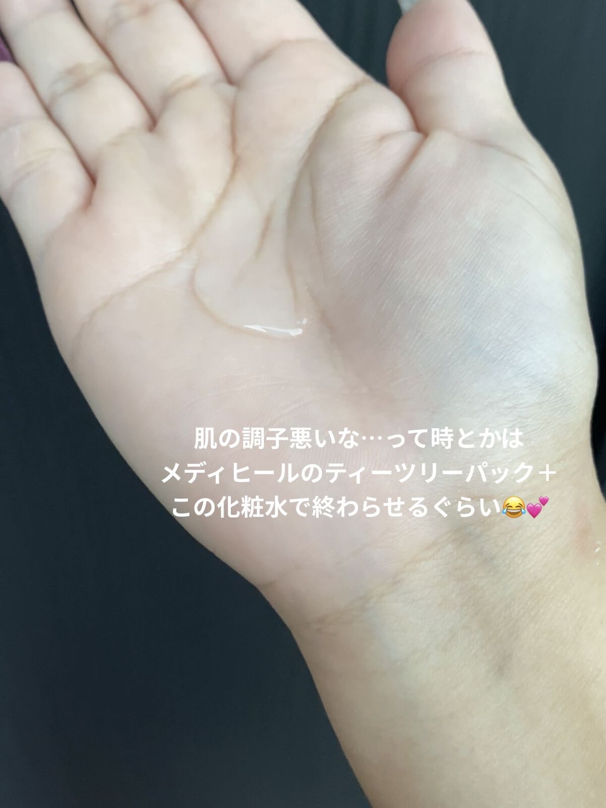 ピンクティーツリートナー/APLIN/化粧水を使ったクチコミ（3枚目）