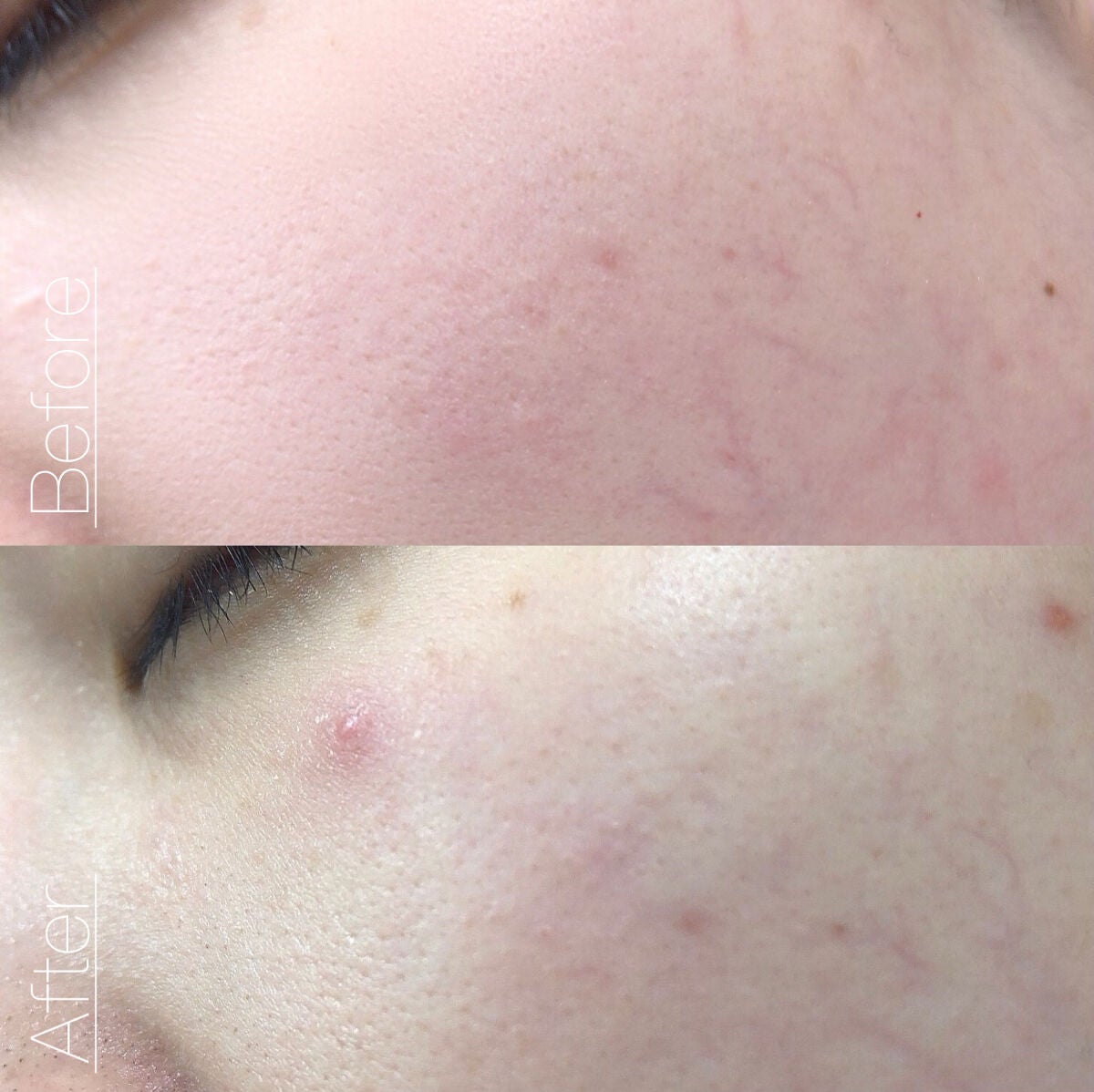 リードルショット100/VT/美容液を使ったクチコミ(5枚目)