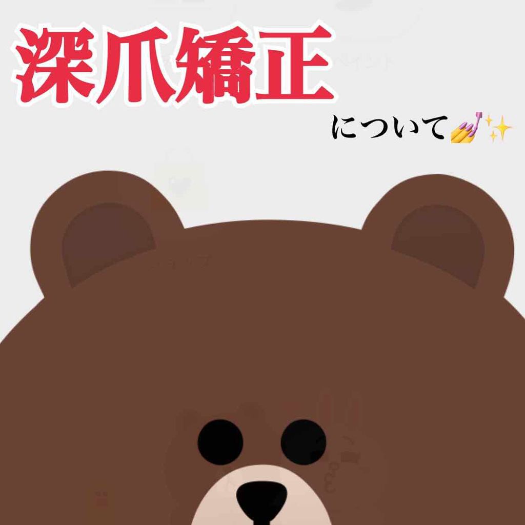 たけち on LIPS 「絶賛深爪の写真は前回の投稿をご覧下さい。深爪矯正について。その..」(1枚目)