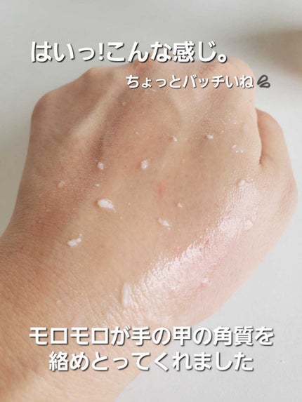 DETクリア ブライト&ピール ピーリングジェリー <ミックスベリーの香り>/Detclear/ピーリングを使ったクチコミ(6枚目)