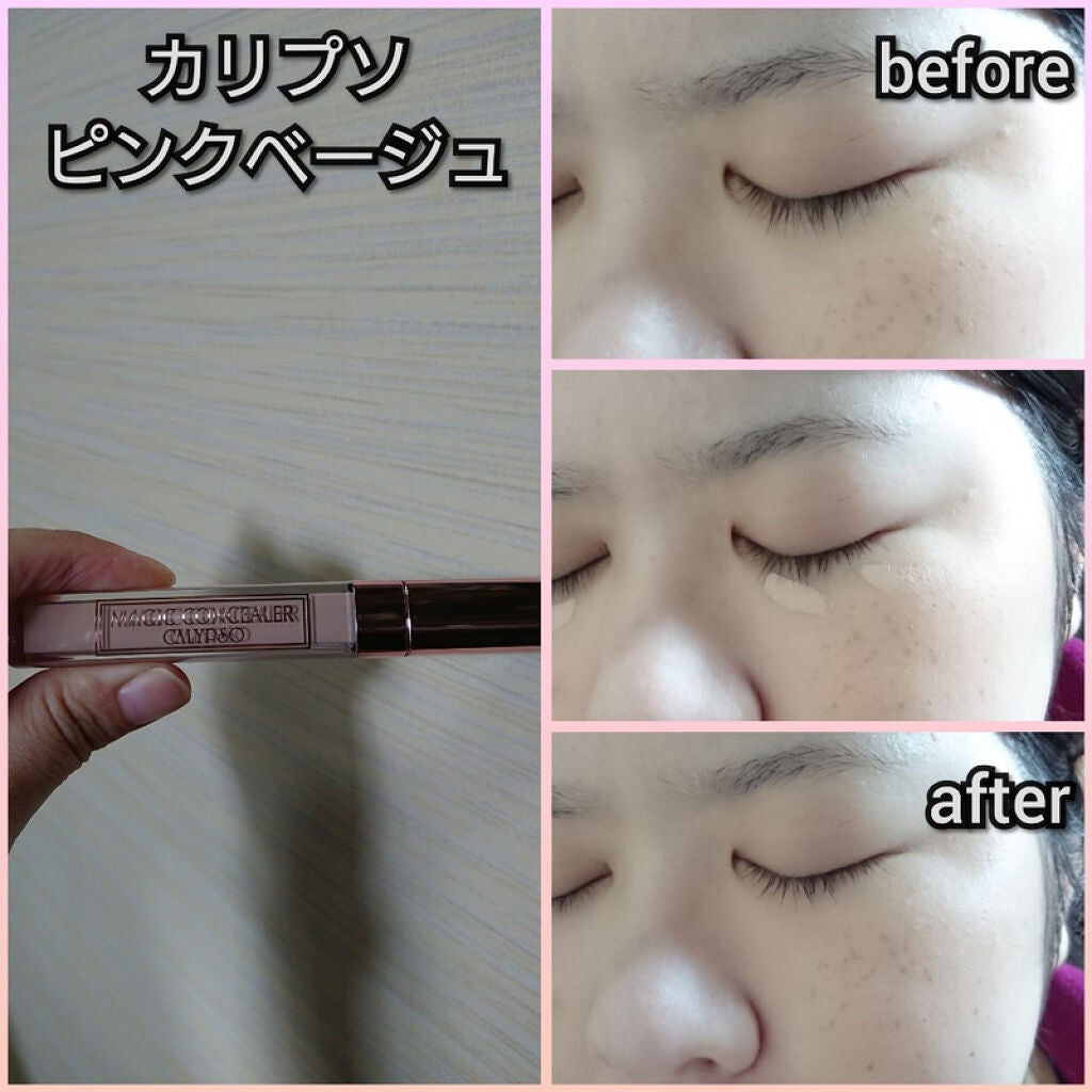 マジックコンシーラー/カリプソ/リキッドコンシーラーを使ったクチコミ(6枚目)