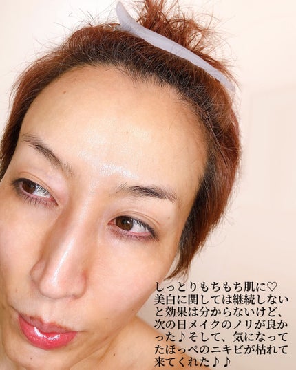 ビタペアCデイリーシートマスク/ネイチャーリパブリック/シートマスク・パックを使ったクチコミ(7枚目)