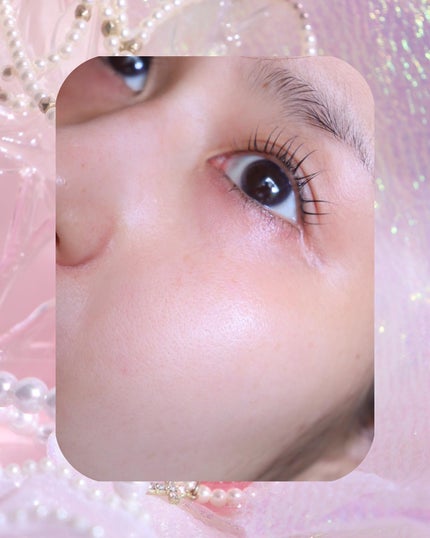 ピンクティーツリーシナジーセラム/APLIN/美容液を使ったクチコミ(3枚目)