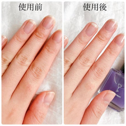 グロスフォーユアネイル/プレビュート/オールインワンネイルを使ったクチコミ(5枚目)