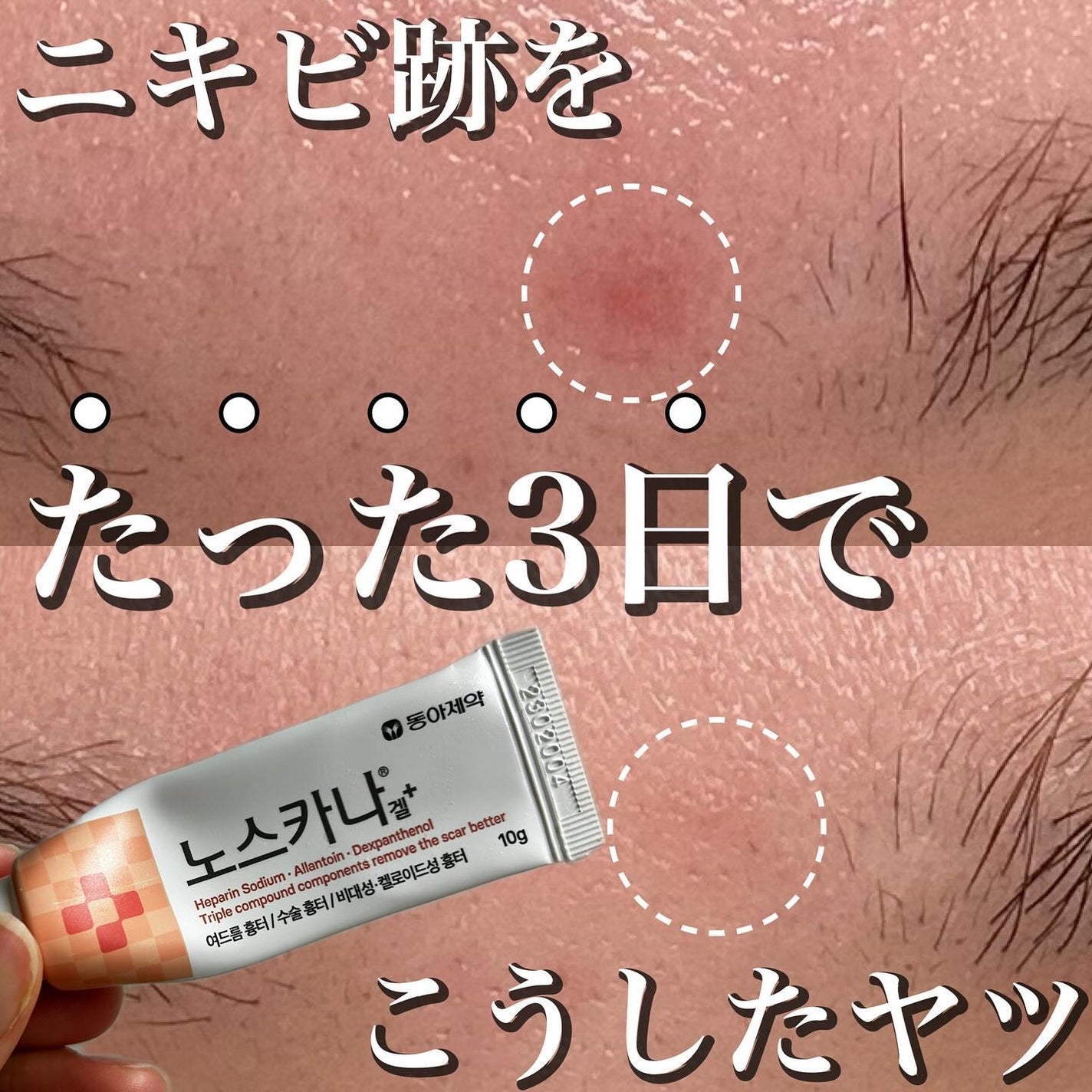 ノスカナゲル/ノスカナゲル/その他スキンケアを使ったクチコミ(1枚目)