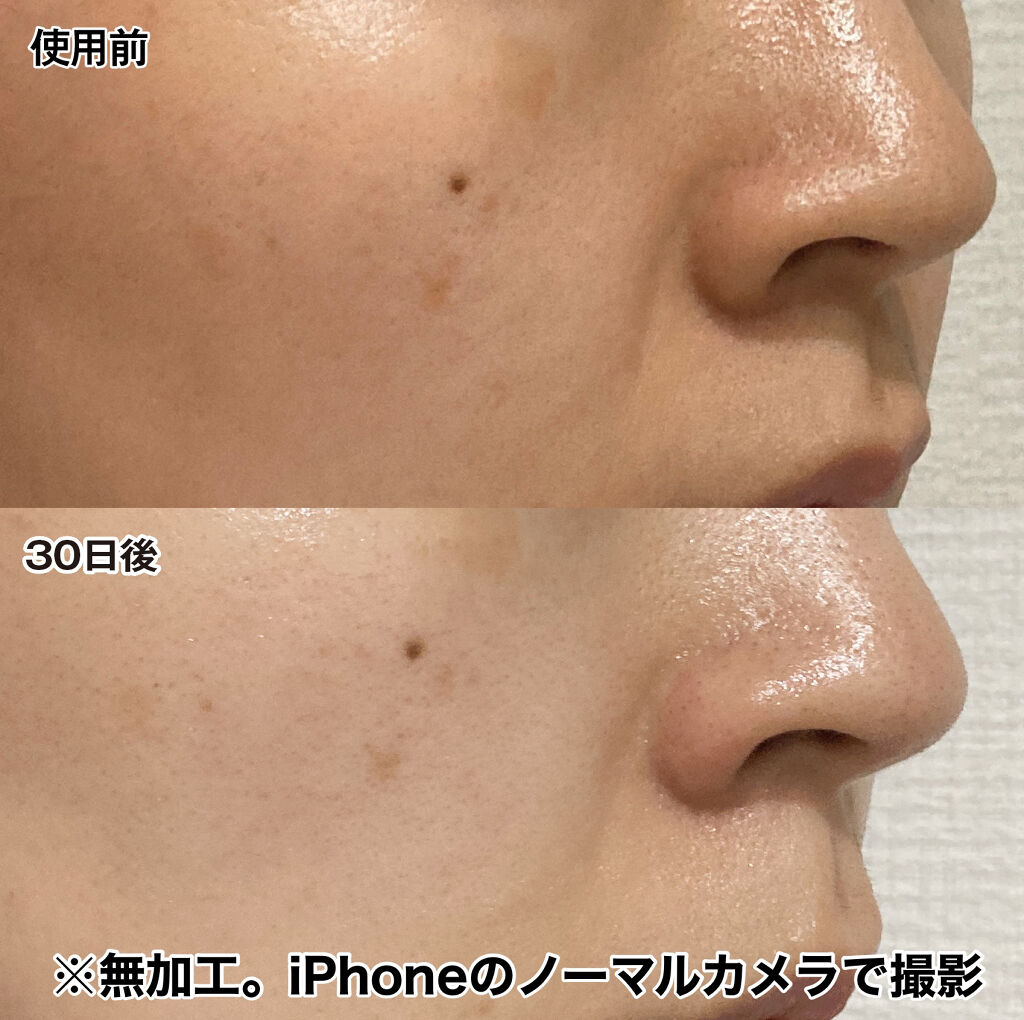 ビタブリッドC フェイス/ビタブリッドジャパン/美容液を使ったクチコミ（3枚目）