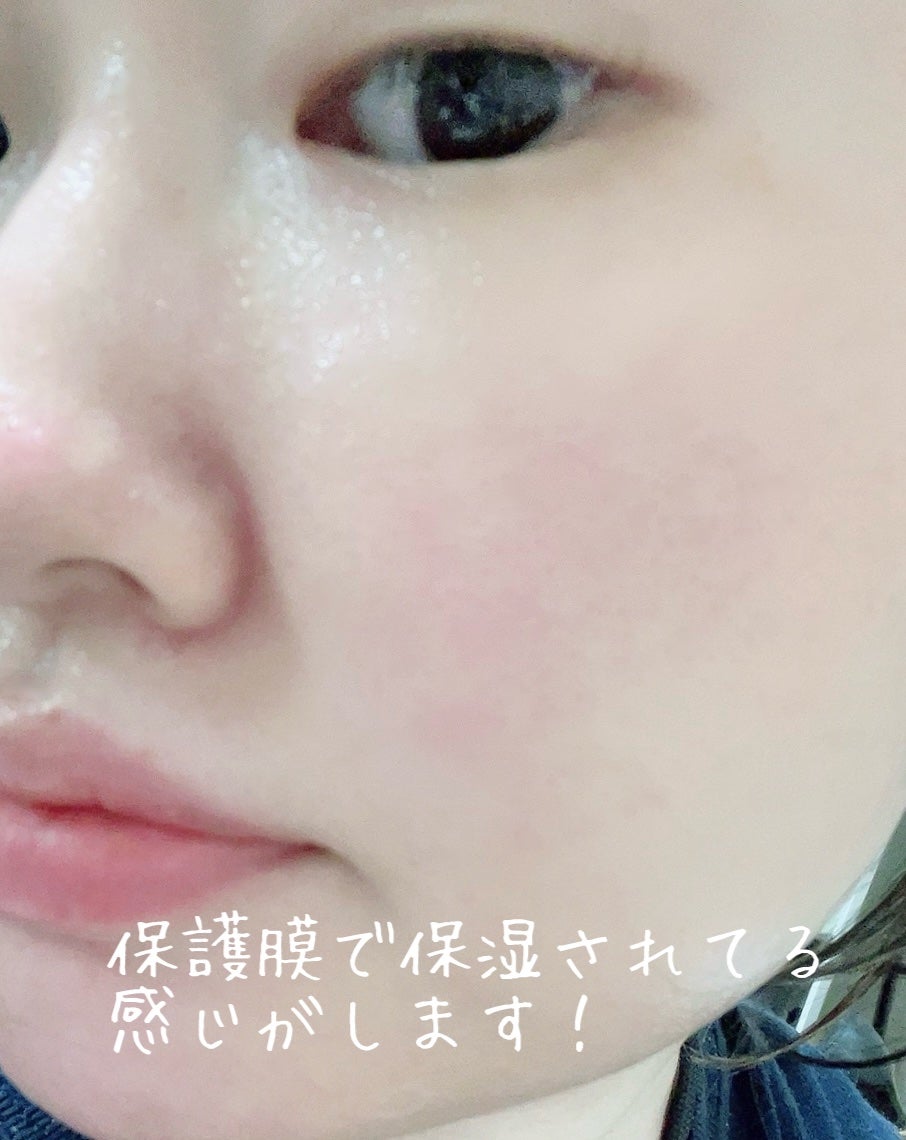 グルカミューンエッセンス /VT/美容液を使ったクチコミ(5枚目)