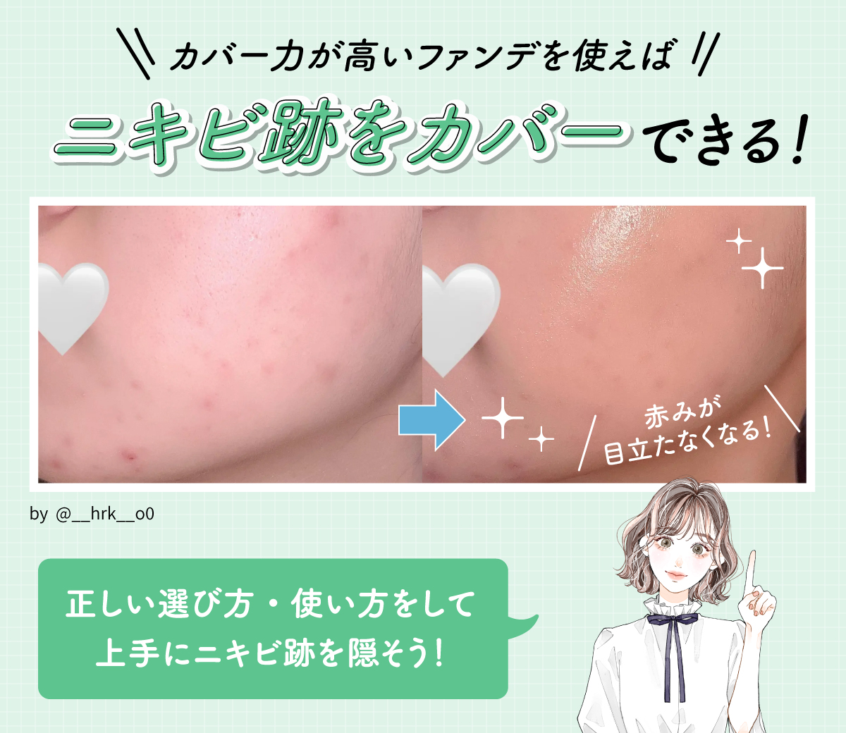 カバー力が高いファンデを使えばニキビ跡をカバーできる！赤みが目立たなくなる！正しい選び方・使い方をして上手にニキビ跡を隠そう！