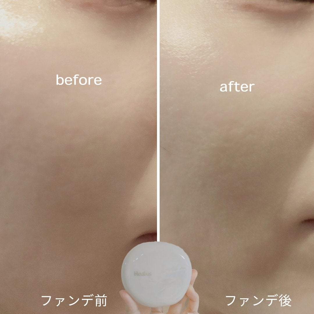 ããªãŒãžã³ã°ã°ããŒã¯ãã·ã§ã³/Healus/ã¯ãã·ã§ã³ãã¡ã³ããŒã·ã§ã³ã䜿ã£ãã¯ãã³ãïŒ8æç®ïŒ