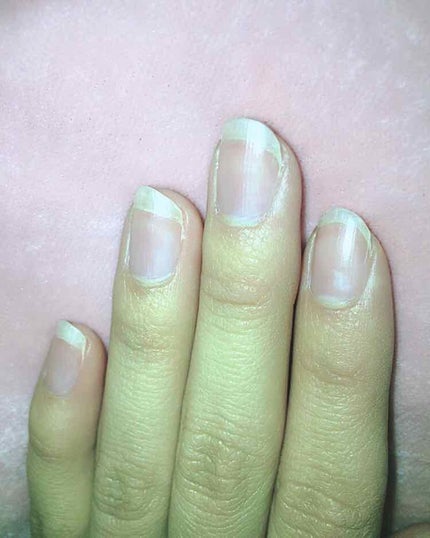 エテュセ クイックケアコート/ettusais/ネイルオイル・トリートメントを使ったクチコミ(2枚目)