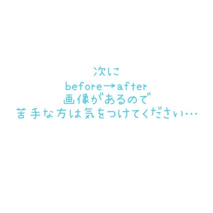ティーツリーアンティセプティックバーム/Tea Tree Therapy/フェイスバームを使ったクチコミ(2枚目)