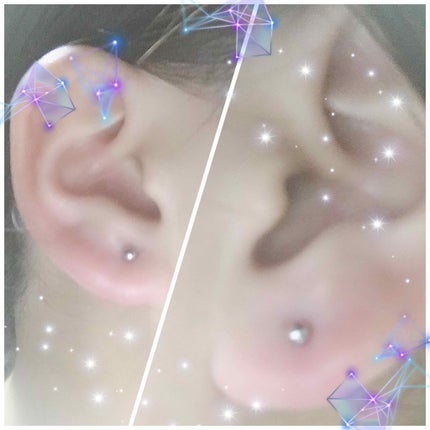 TSUNAMI on LIPS 「初めてピアスデビューしました👂🏻✨印を付けたとこを開けれたので..」(2枚目)