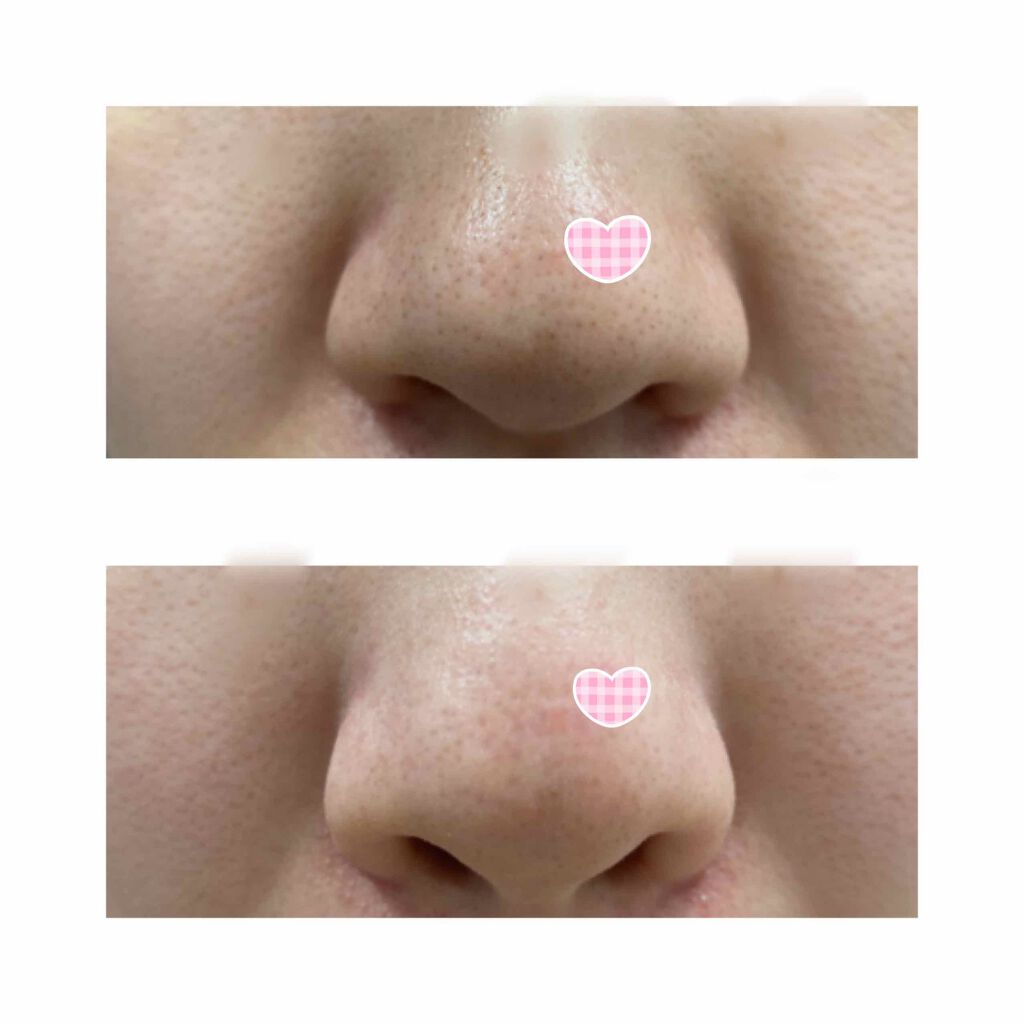 スーパーヴォルカニック ポア クレイマスク/innisfree/洗い流すパック・マスクを使ったクチコミ(3枚目)