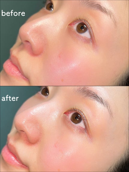 メラノショット W マスク/ONE BY KOSE/シートマスク・パックを使ったクチコミ(5枚目)