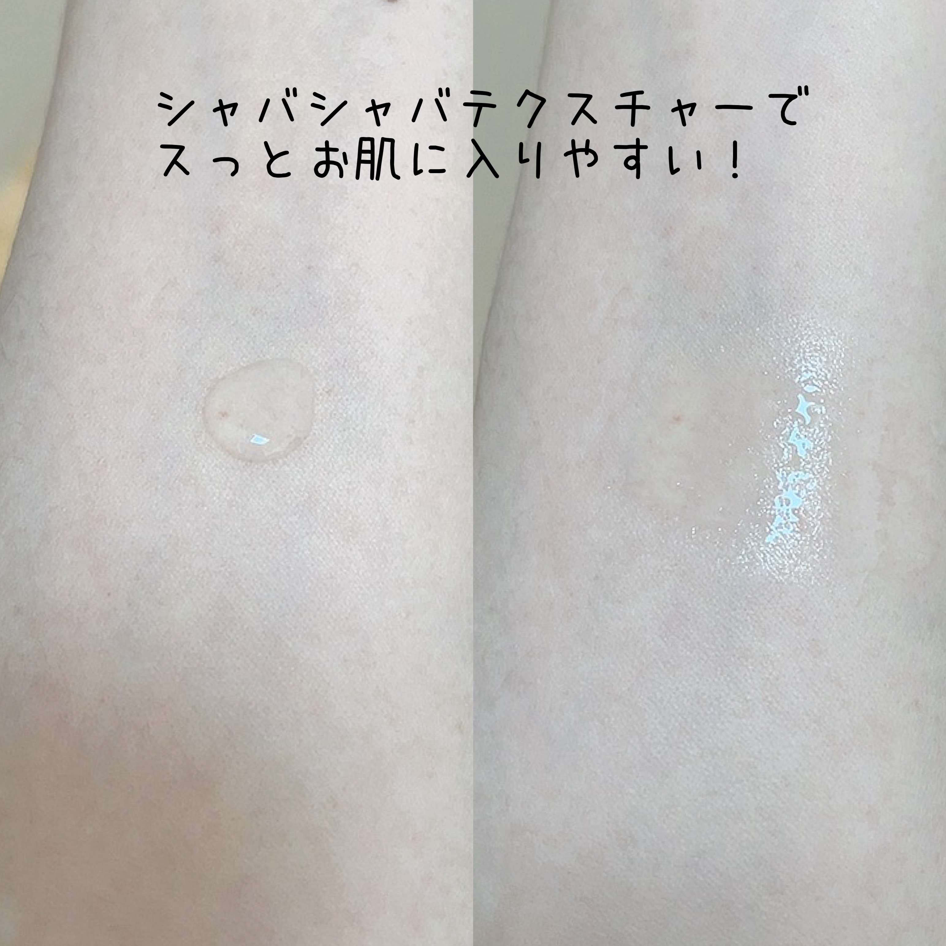 肌美精　　大人のニキビ対策 薬用美白化粧水　[医薬部外品]/肌美精/化粧水を使ったクチコミ（2枚目）