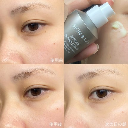 ヴィーガンリポソームレチノールセラム/SKIN&LAB/美容液を使ったクチコミ(2枚目)