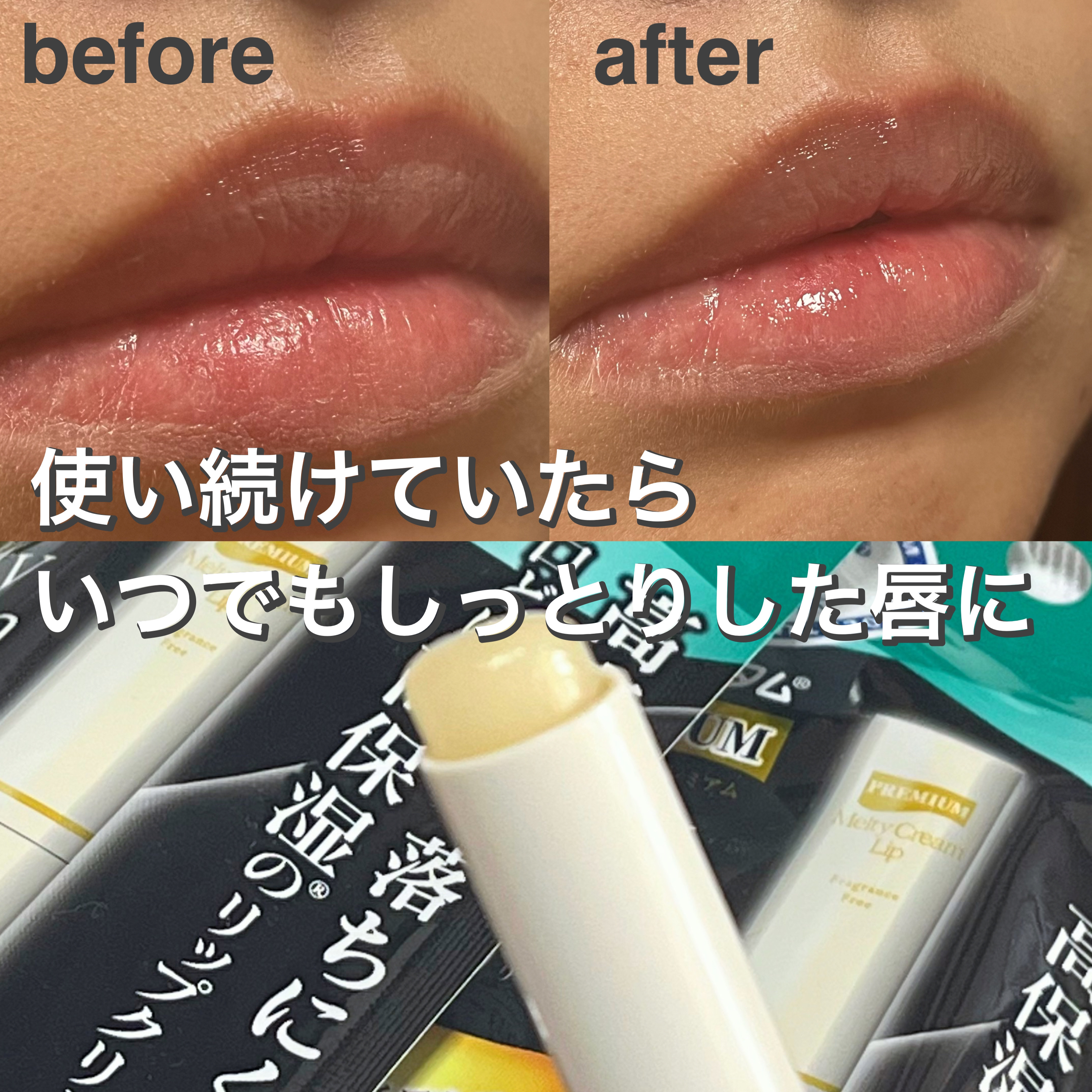 プレミアムメルティリップ/メンソレータム/リップクリームを使ったクチコミ（2枚目）