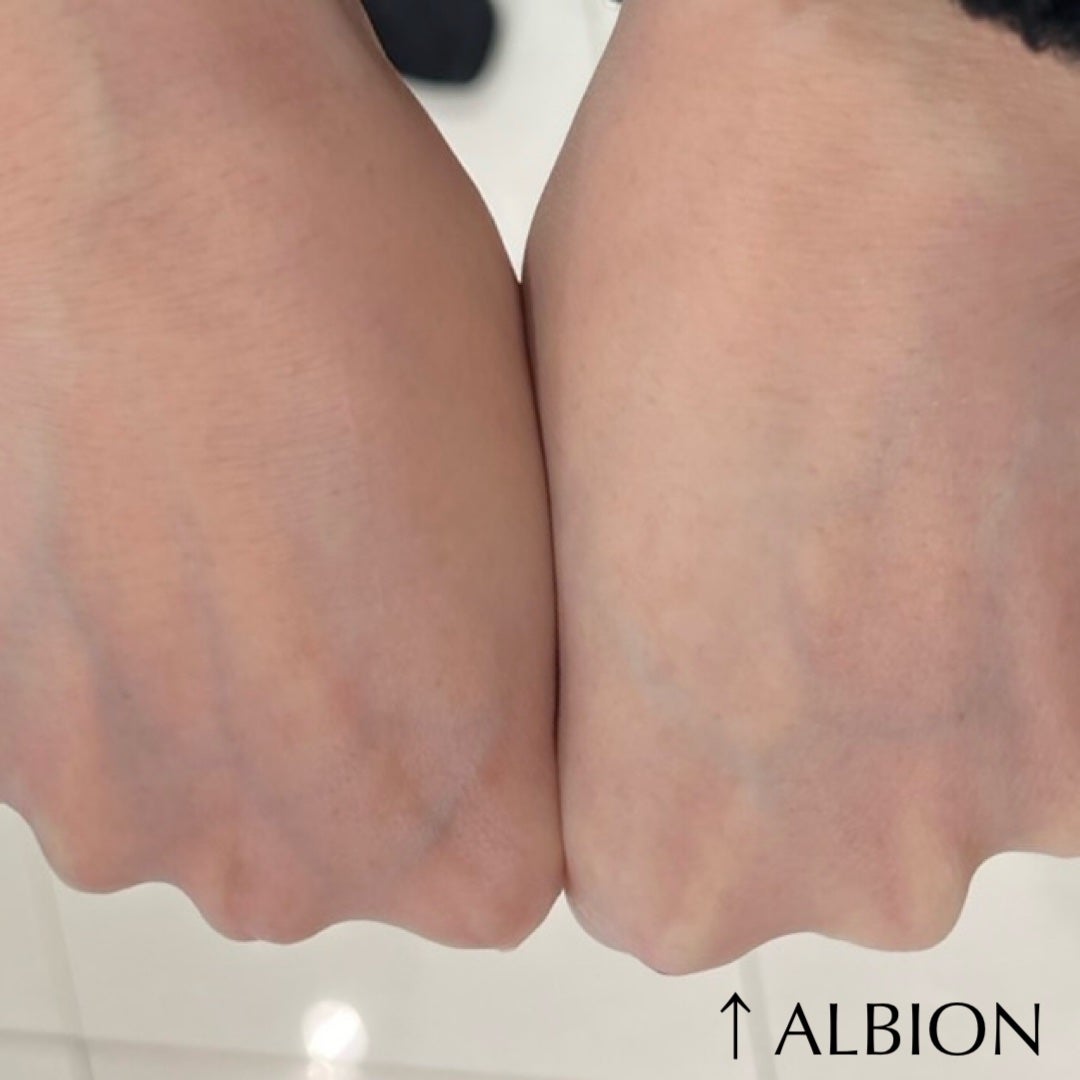 セルフホワイトニング ミッション/ALBION/美容液を使ったクチコミ(4枚目)