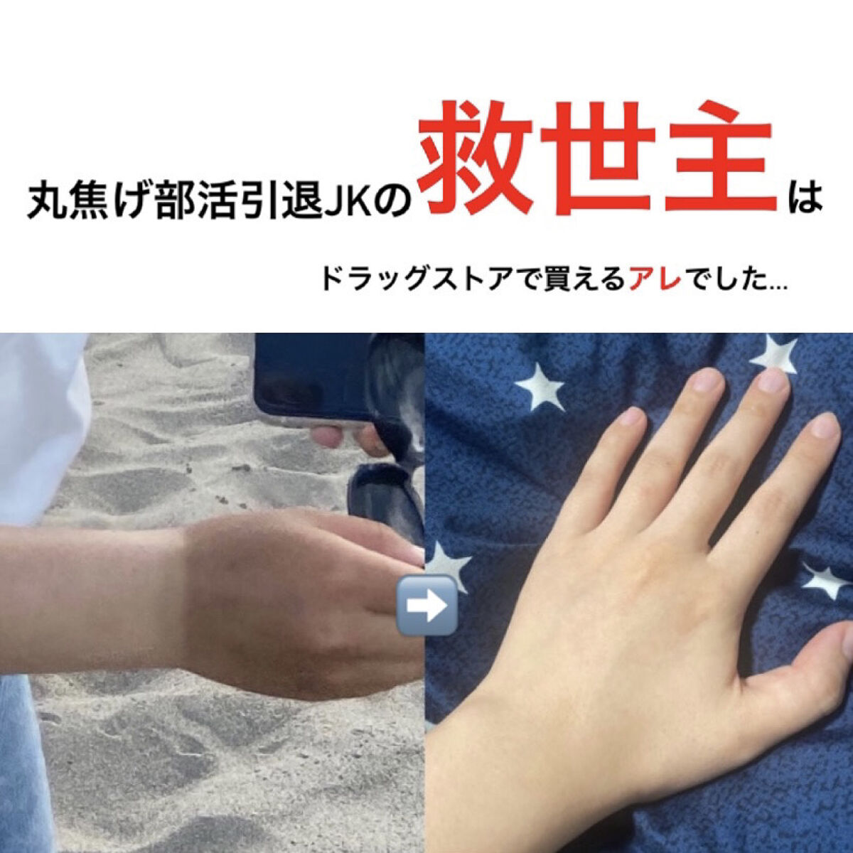 DHC ビタミンＣハードカプセル/DHC/美容サプリメントを使ったクチコミ（1枚目）