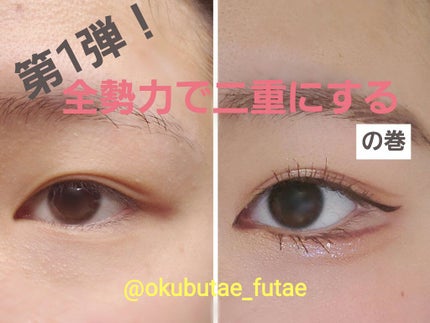 アイビューティー フィクサー WP/アストレア ヴィルゴ/二重まぶた用アイテムを使ったクチコミ(1枚目)