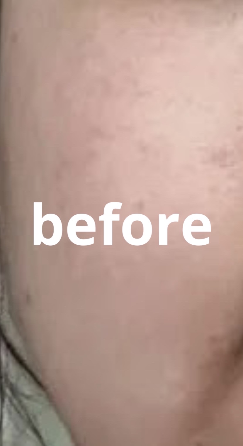 RXザ・レチノール0.1クリーム/COSRX/フェイスクリームを使ったクチコミ（3枚目）