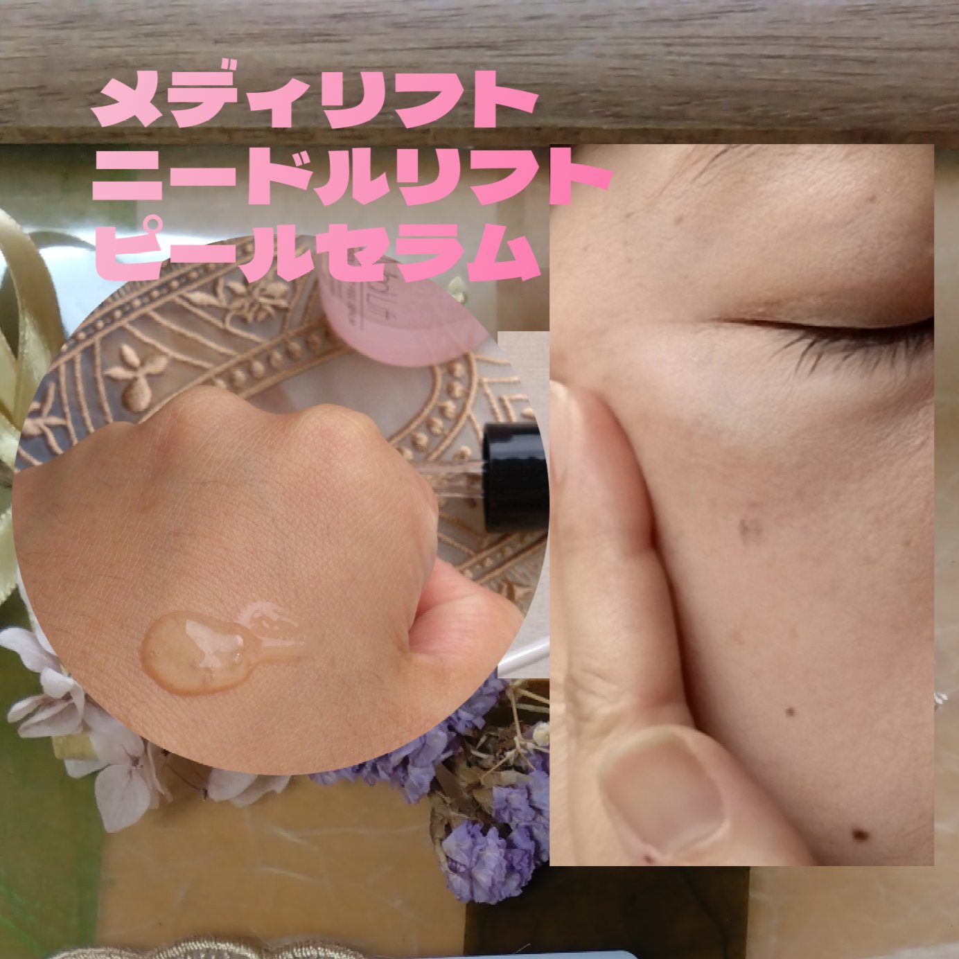 メディリフト ニードルリフトピールセラム/YA-MAN TOKYO JAPAN/美容液を使ったクチコミ（2枚目）