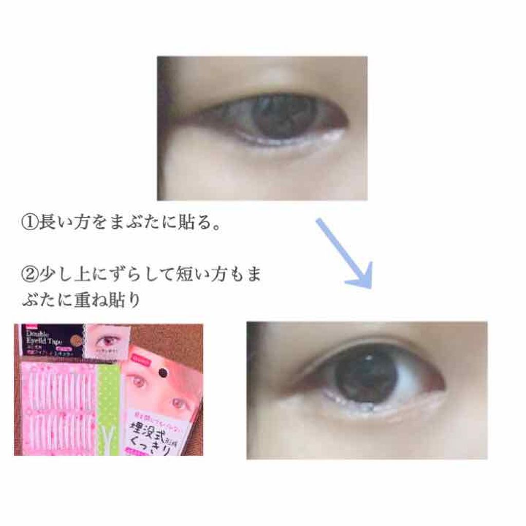 アイテープ 埋没式両面テープ/DAISO/二重まぶた用アイテムを使ったクチコミ(2枚目)