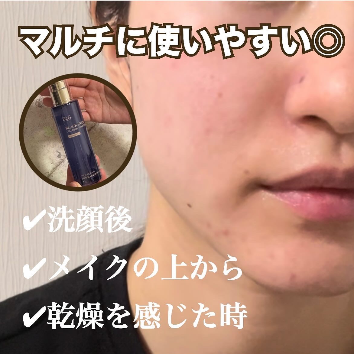 ドクタージー ブラックスネイル コラーゲンミスト/Dr.G/ミスト状化粧水を使ったクチコミ（2枚目）