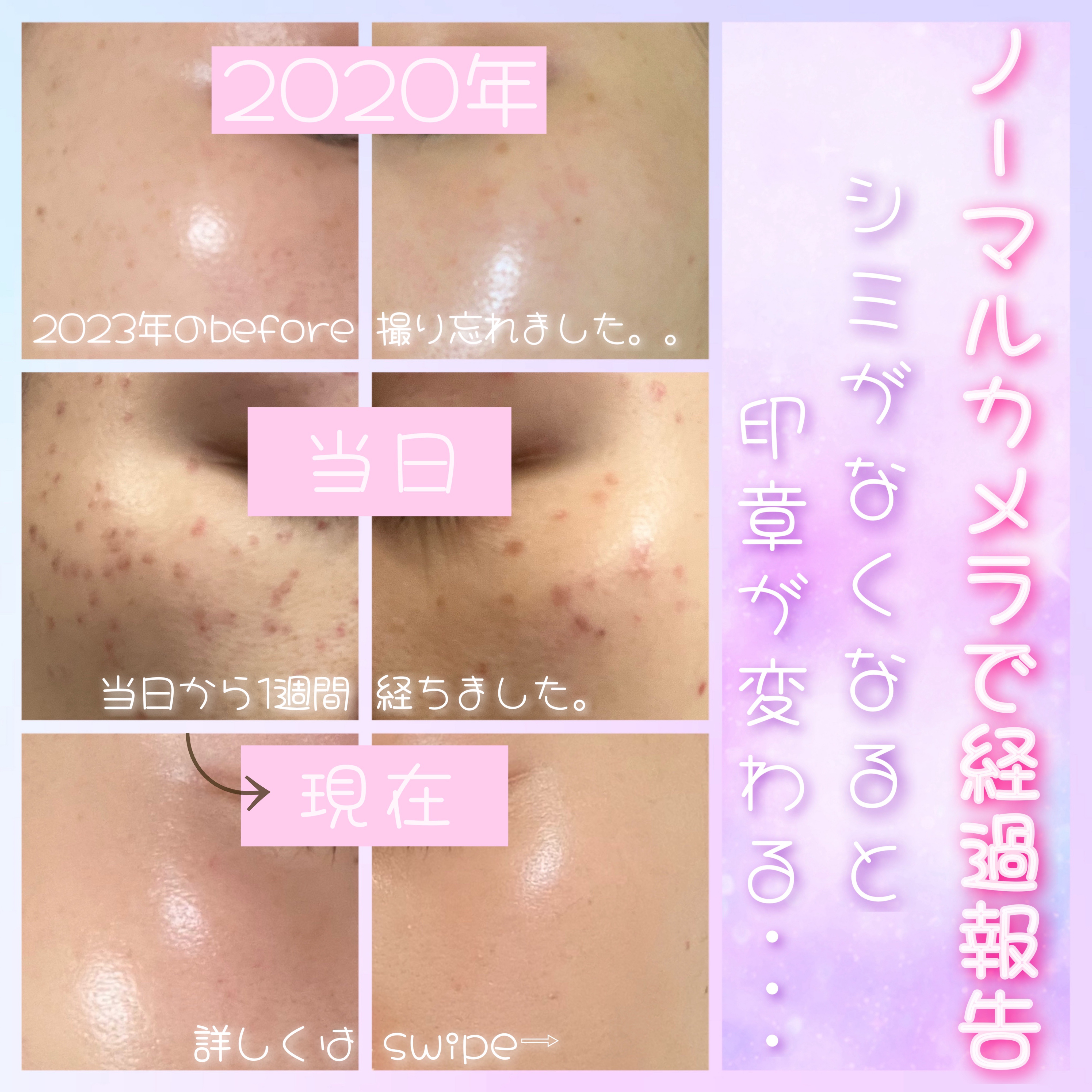 スキンブライセラム/ZO Skin Health/美容液を使ったクチコミ（1枚目）