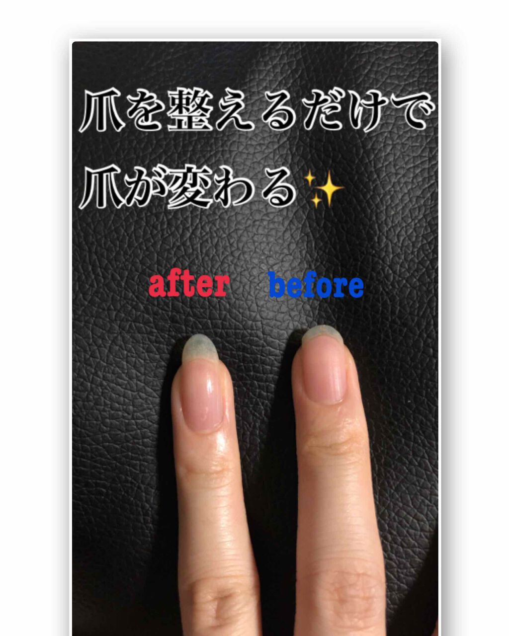 ウィンマックス ネイルハードナー/DAISO/ネイルオイル・トリートメントを使ったクチコミ(1枚目)