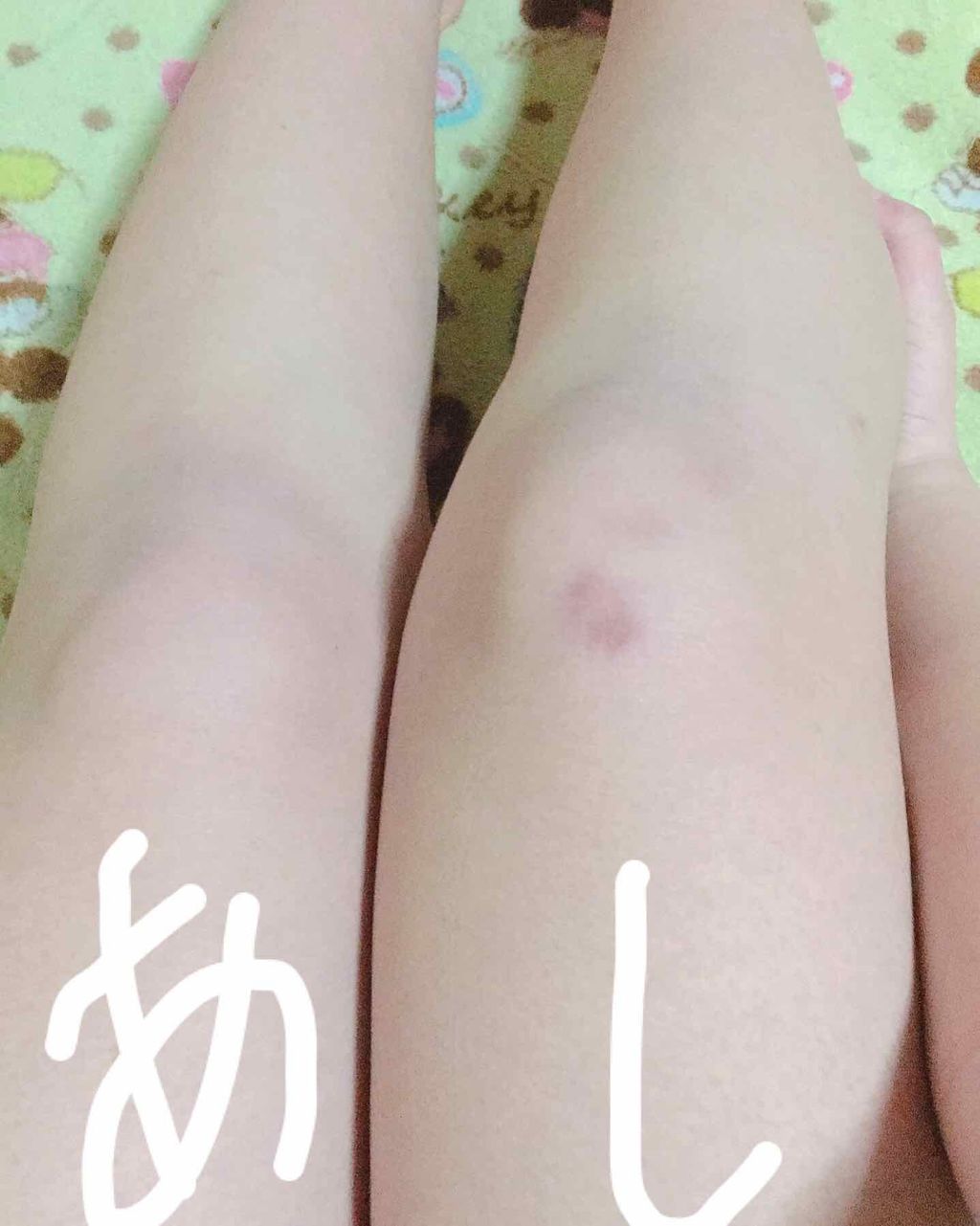 あくち on LIPS 「はじめまして😶初投稿なので少し緊張してます☔☁️私は写真をみて..」(3枚目)