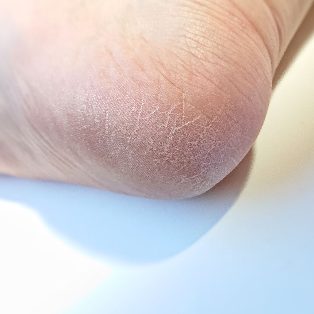 薬用 フットソープF1 フレッシュハーブ/フットメジ/レッグ・フットケアを使ったクチコミ(2枚目)