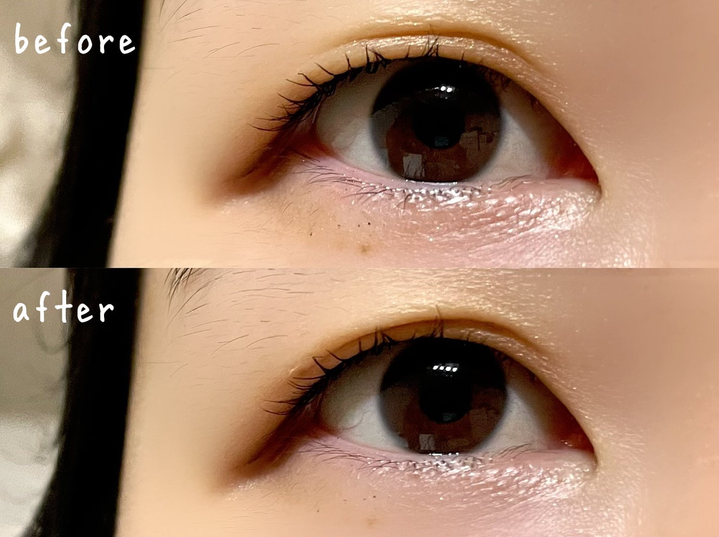 メザイク イージークリア 接着クリアタイプ/メザイク/二重まぶた用アイテムを使ったクチコミ(2枚目)