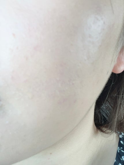 フォトプラス シャイニー/YA-MAN TOKYO JAPAN/美顔器・マッサージを使ったクチコミ(1枚目)